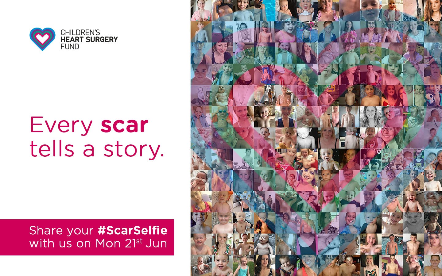 CHSF #ScarSelfie (21 June) share image